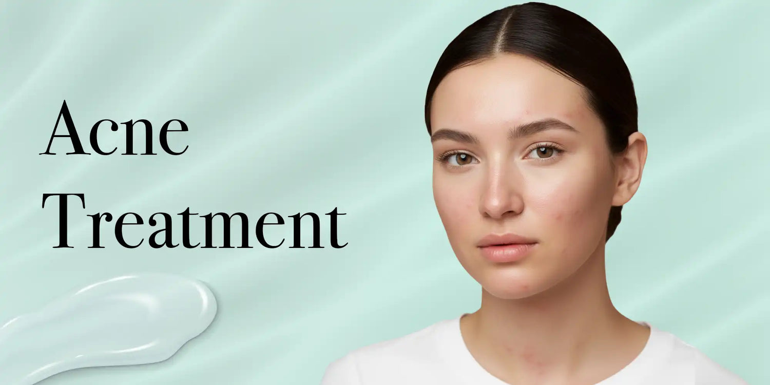 Acne Treatment